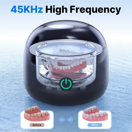 71Mg1KeDJiL._SL1500_